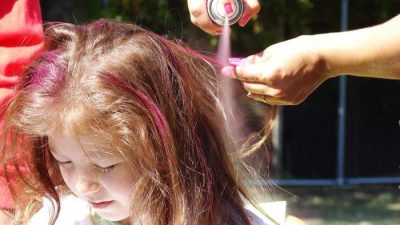 Cara Ampuh Mengatasi Ketombe: Solusi Jitu untuk Rambut Sehat