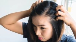 Cara Agar Rambut Tidak Cepat Lepek