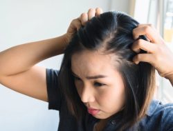 Cara Agar Rambut Tidak Cepat Lepek