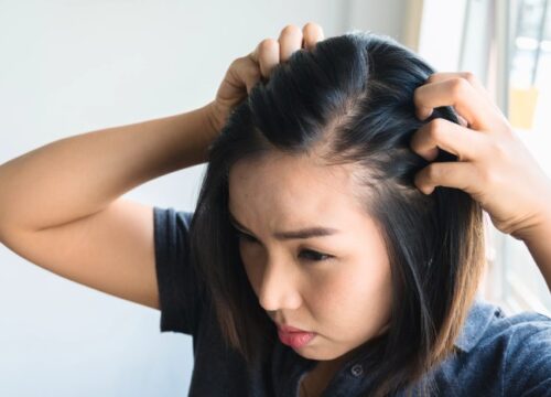 Cara Agar Rambut Tidak Cepat Lepek