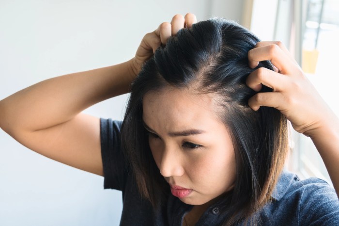 Cara agar rambut tidak cepat lepek