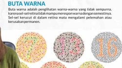 Cara mengatasi buta warna parsial