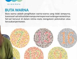 Cara Mengatasi Buta Warna Parsial: Tips dan Solusi Praktis