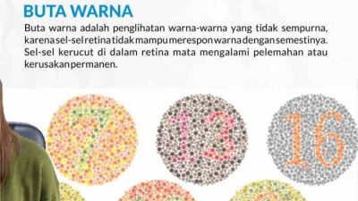 Cara mengatasi buta warna parsial