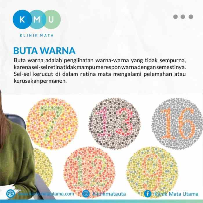 Cara mengatasi buta warna parsial