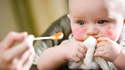 Cara mengatasi alergi makanan pada bayi