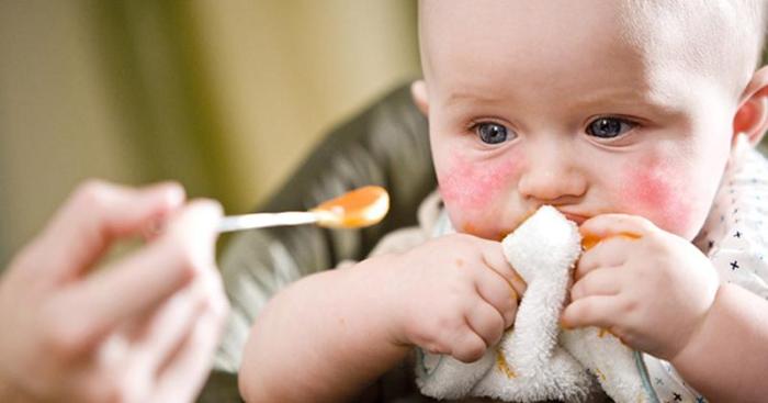 Cara mengatasi alergi makanan pada bayi