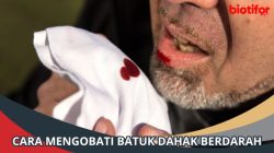 Cara Mengatasi Dahak Berdarah: Panduan Lengkap
