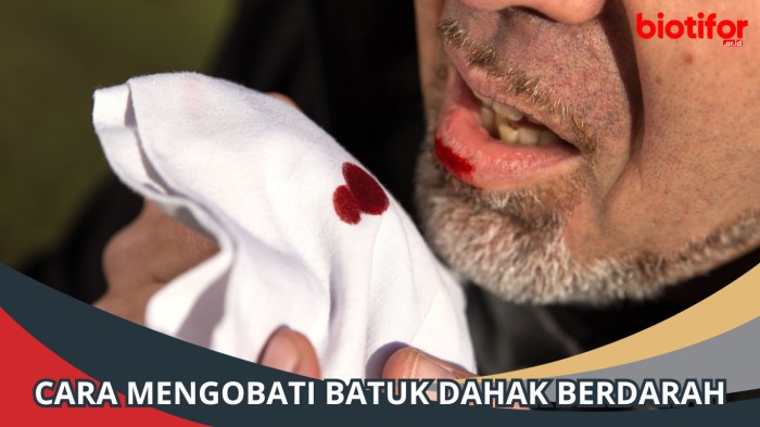 Cara mengobati dahak berdarah