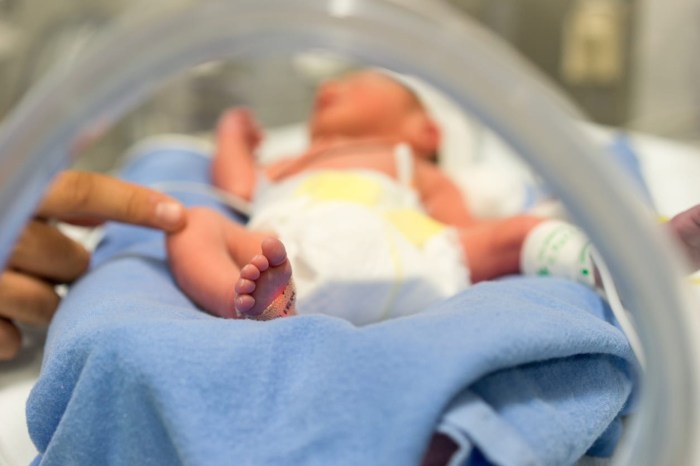 Cara merawat bayi prematur 8 bulan