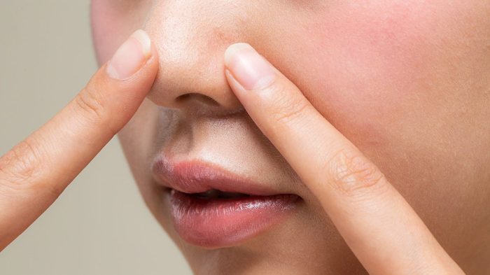 Cara ampuh menghilangkan komedo di hidung