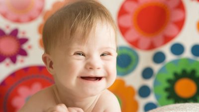 Cara mencegah down syndrome saat hamil