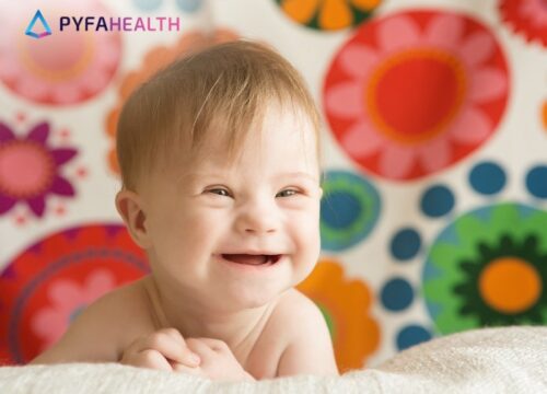 Cara Mencegah Down Syndrome Saat Hamil: Panduan Langkah Demi Langkah