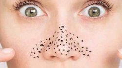 Cara Ampuh Hilangkan Komedo di Hidung: Panduan Lengkap