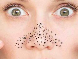 Cara Ampuh Hilangkan Komedo di Hidung: Panduan Lengkap