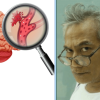 Cara Mengatasi Pembuluh Darah Pecah: Pencegahan, Diagnosis, dan Pengobatan