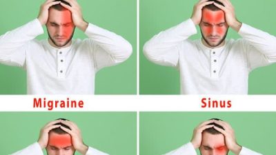Berbagai Jenis Sakit Kepala dan Cara Efektif Mengatasinya
