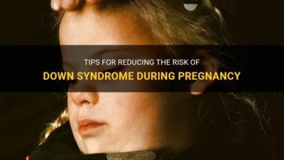 Cara mencegah down syndrome saat hamil