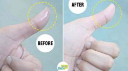 Cara Mudah Menghilangkan Lem Korea yang Menempel di Kulit