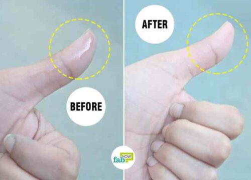 Cara Mudah Menghilangkan Lem Korea yang Menempel di Kulit