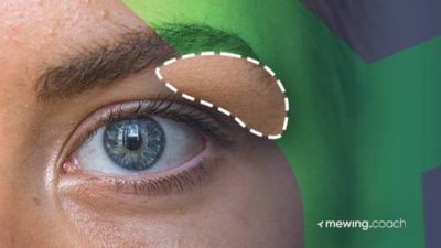 Cara menghilangkan kelopak mata berlipat