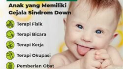 Cara Mencegah Down Syndrome Saat Hamil Upaya, Pemeriksaan, dan Dukungan