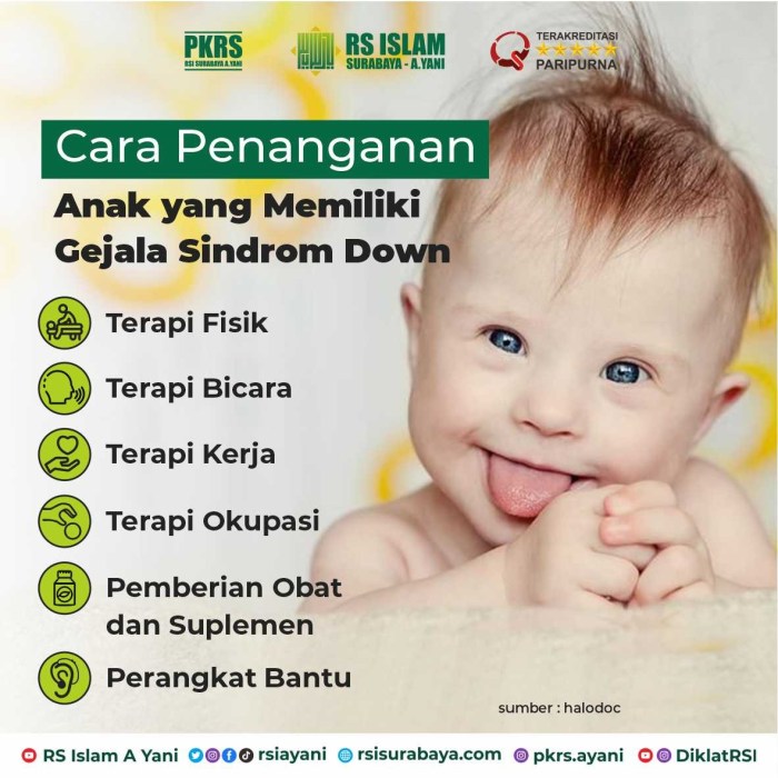 Cara mencegah down syndrome saat hamil