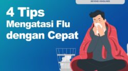 Cara mengobati penyakit influenza