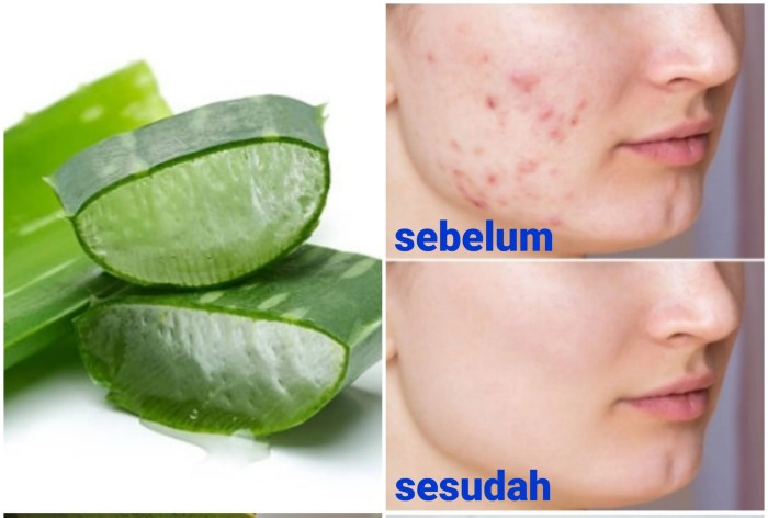 Cara Menggunakan Lidah Buaya di Wajah Manfaat, Persiapan, dan Tips Ampuh