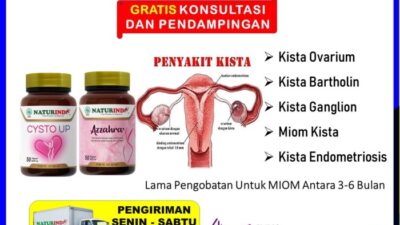 Cara menghilangkan miom secara alami