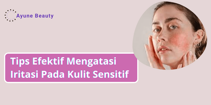 Cara mengatasi iritasi kulit wajah
