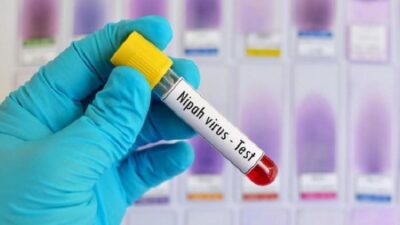 Cara penularan virus nipah