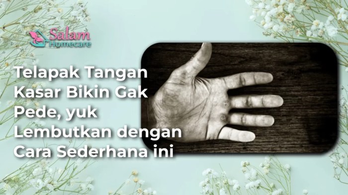 Cara mengatasi telapak tangan kasar