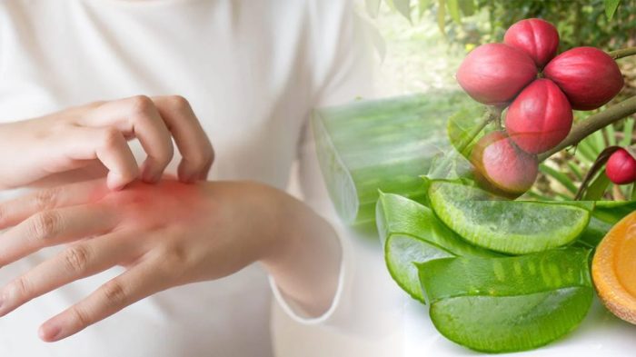 Cara Menghilangkan Gatal pada Kulit yang Tak Kunjung Sembuh Panduan Lengkap