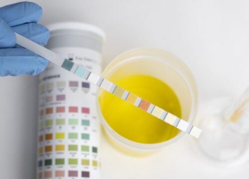 Cara Menghitung Urine Normal Panduan Lengkap untuk Kesehatan Anda