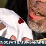 Cara Mengatasi Dahak Berdarah: Panduan Lengkap
