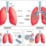 Bagaimana Cara Menjaga Kesehatan Organ Pernapasan Panduan Lengkap