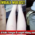 Cara Menghilangkan Lem Korea di Kulit Panduan Lengkap dan Efektif