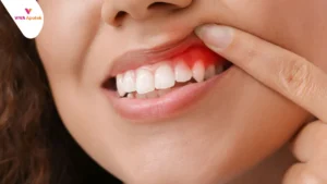 featured-image