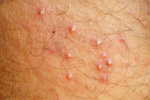 featured-image
