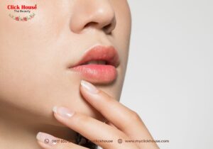 featured-image