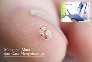 featured-image