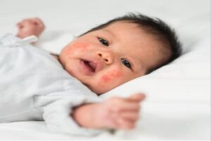 featured-image